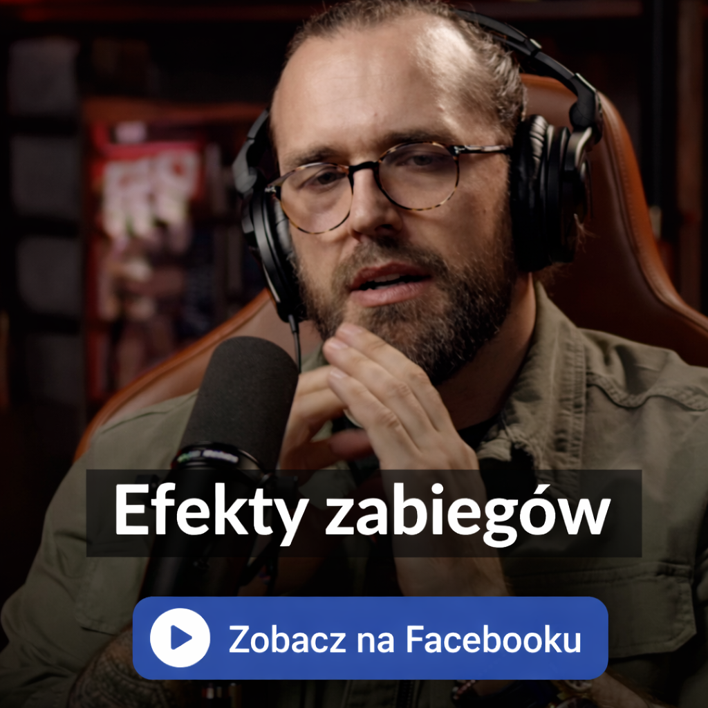 Efekty zabiegów – Facebook Reel